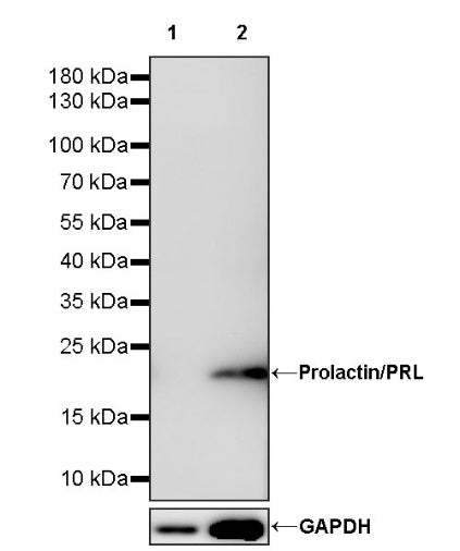 Prolactin/PRL Recombinant Rabbit mAb (S-235-215)