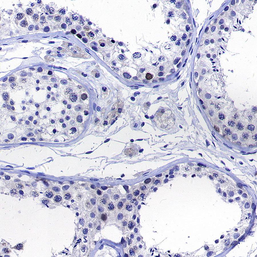 CENP-F Recombinant Rabbit mAb (S-3148-75)