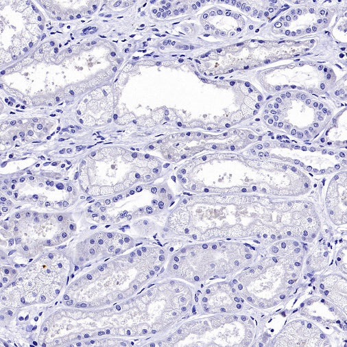 LIN28A Rabbit Polyclonal Antibody