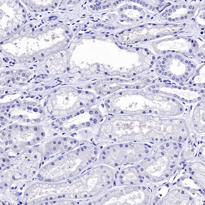 LIN28A Rabbit Polyclonal Antibody