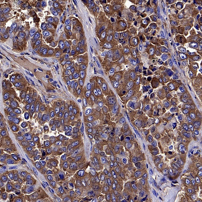 LY6E/SCA-2 Recombinant Rabbit mAb (S-2681-56)