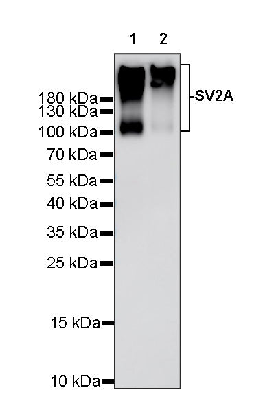 SV2A Recombinant Rabbit mAb (S-3732-3)