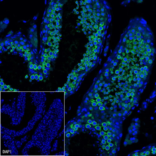 DDX4 Recombinant Rabbit mAb (S-1570-48)