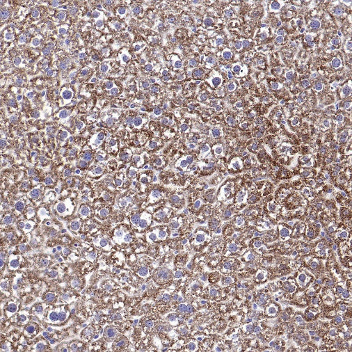 Catalase Recombinant Rabbit mAb (S-1925-3)
