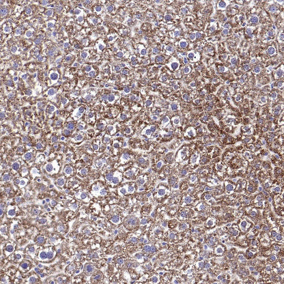 Catalase Recombinant Rabbit mAb (S-1925-3)