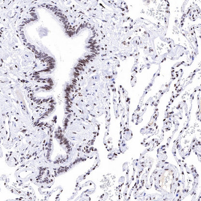 Histone H3 (di methyl K14) Recombinant Rabbit mAb (S-R414)