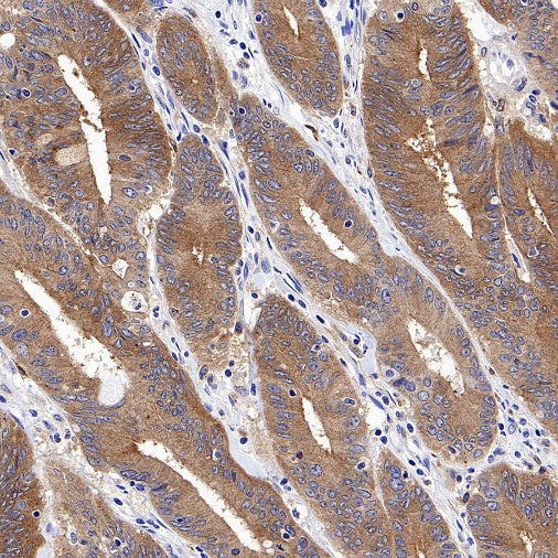 Src Recombinant Rabbit mAb (S-1181-16)