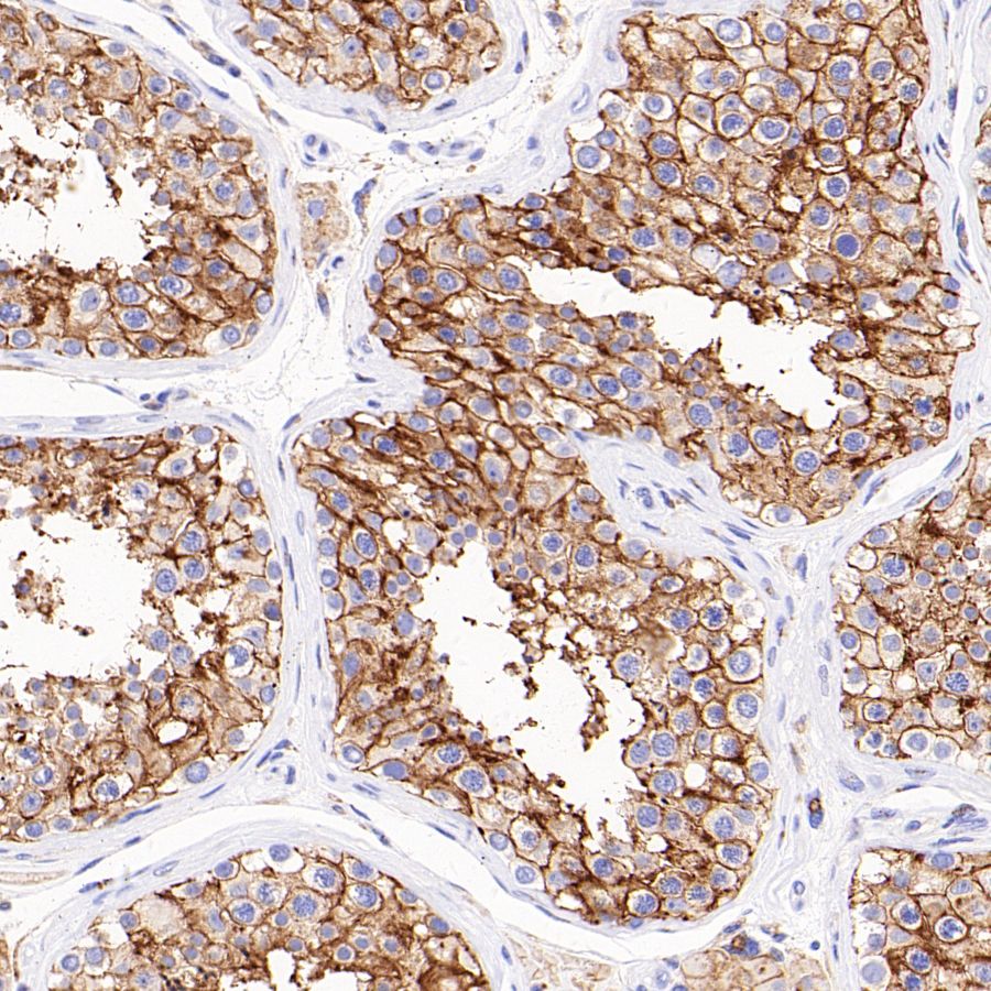 CD98/SLC3A2 Recombinant Rabbit mAb (SDT-2038-19)