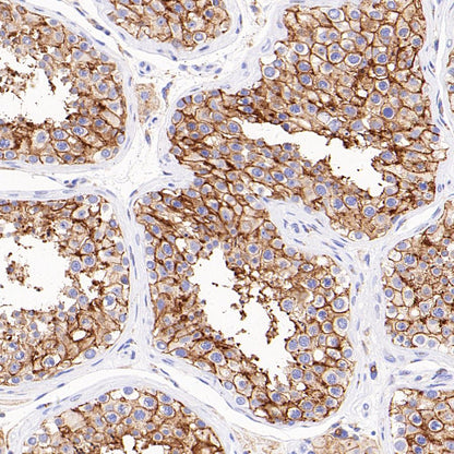 CD98/SLC3A2 Recombinant Rabbit mAb (SDT-2038-19)