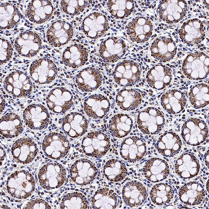 LONP1 Rabbit Polyclonal Antibody
