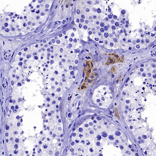 StAR Recombinant Rabbit mAb (S-2520-24)