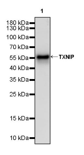 TXNIP Recombinant Rabbit mAb (S-2476-80)