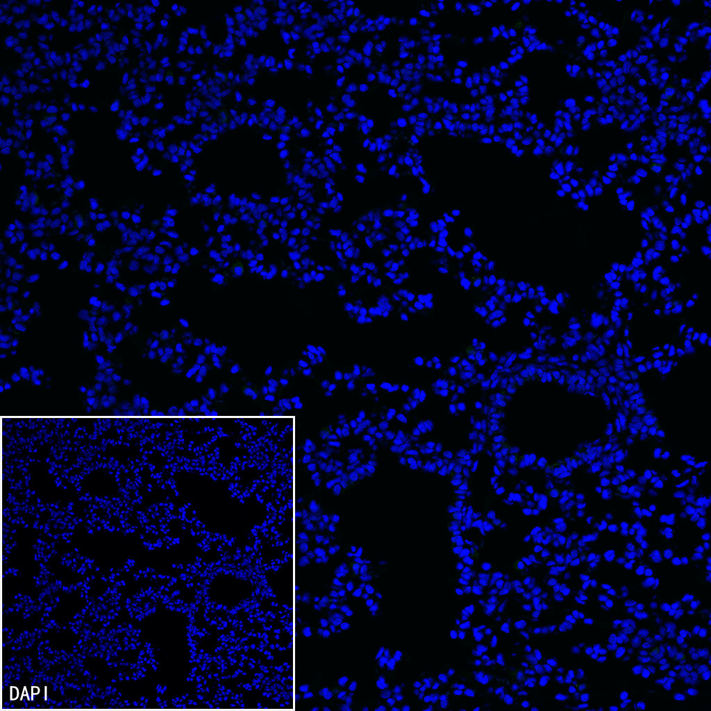 Homer1 Recombinant Rabbit mAb (S-3405-360)