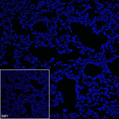 Homer1 Recombinant Rabbit mAb (S-3405-360)