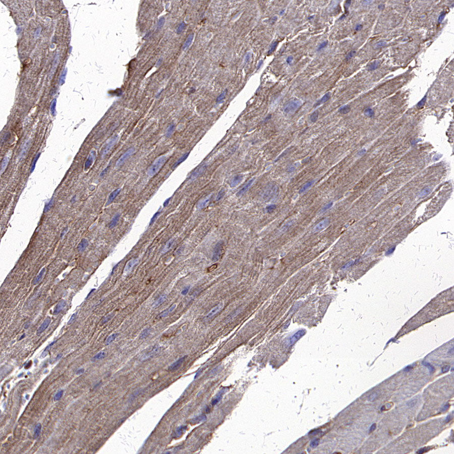 Beta Actin Recombinant Mouse mAb (S-5033)