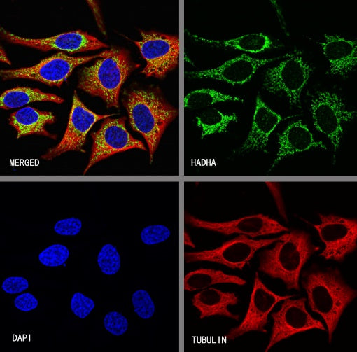 HADHA Recombinant Rabbit mAb (S-2345-8)