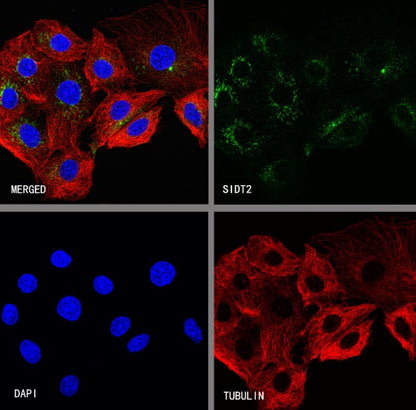 SIDT2 Recombinant Rabbit mAb (S-3763-76)