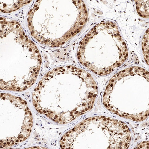 XPO1/CRM1 Recombinant Rabbit mAb (S-3309-7)