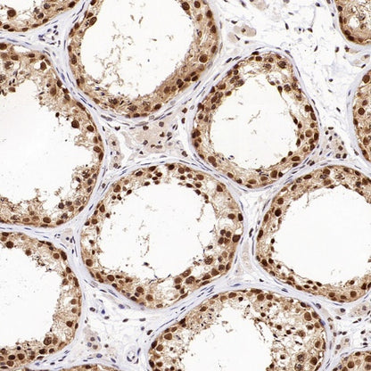 XPO1/CRM1 Recombinant Rabbit mAb (S-3309-7)