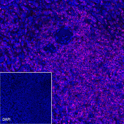 CD45 Recombinant Rabbit mAb (Alexa Fluor® 647 Conjugate) (S-R035)