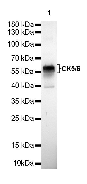 S-RMab® CK5/6 Recombinant Rabbit mAb,PBS Only (SDT-P004)