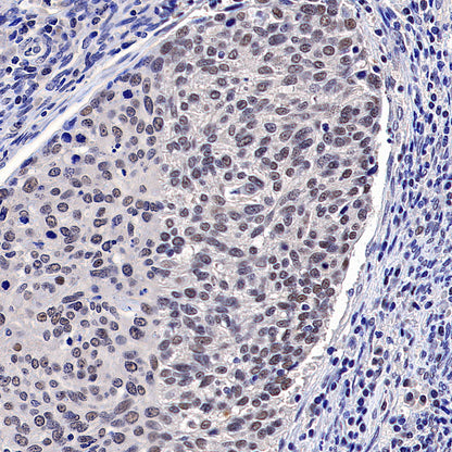 PAPSS1 Recombinant Rabbit mAb (S-3516-9)