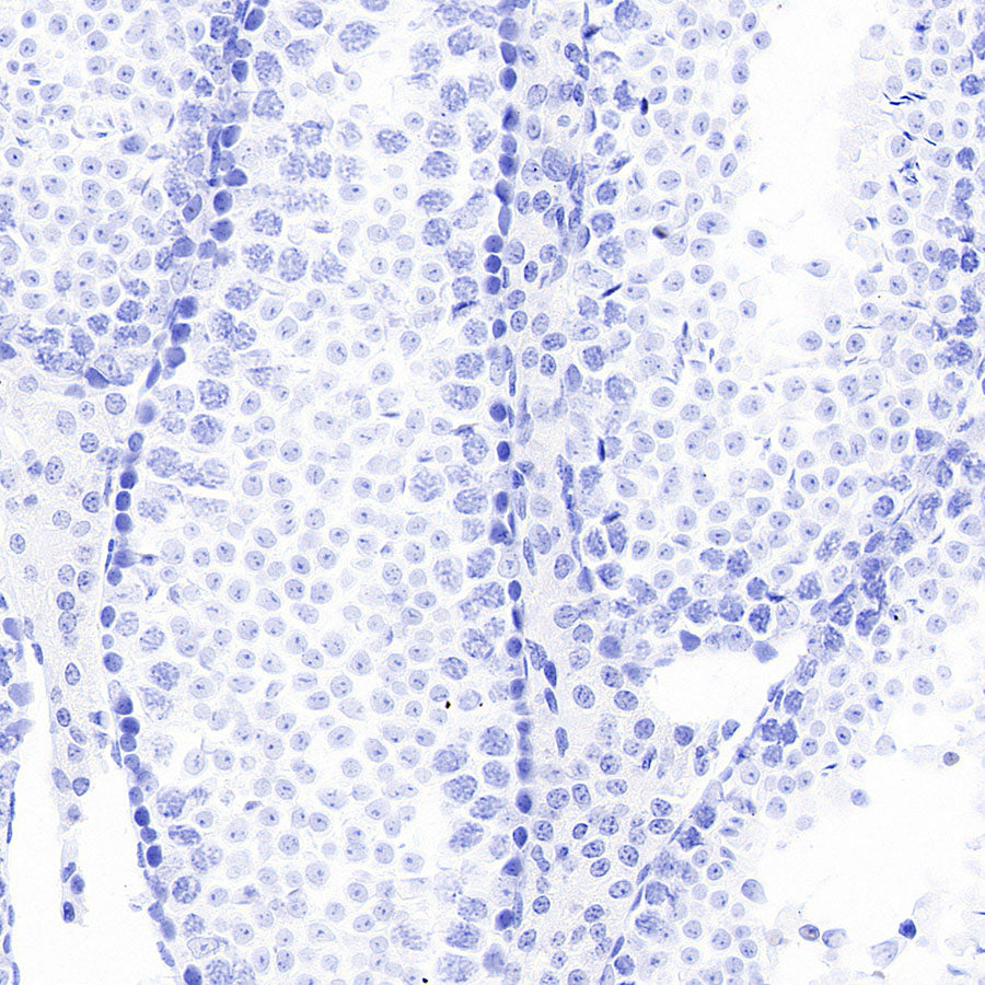 ITPR1 Recombinant Rabbit mAb (S-4530-47)