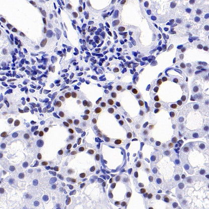 KDM1/LSD1 Recombinant Rabbit mAb (S-1280-80)