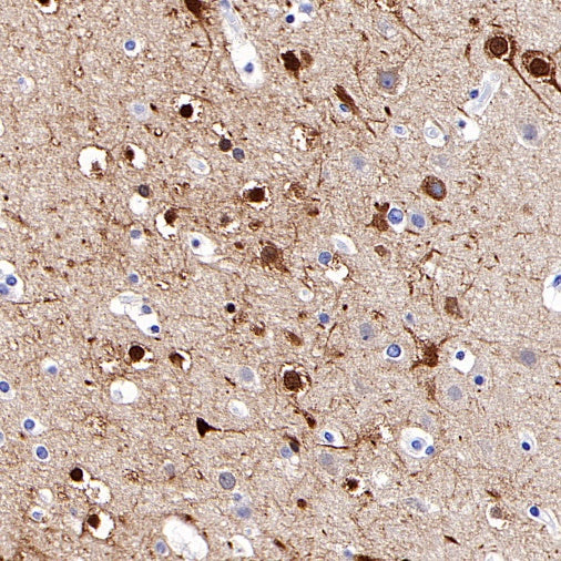 Beta II tubulin Rabbit polyclonal antibody