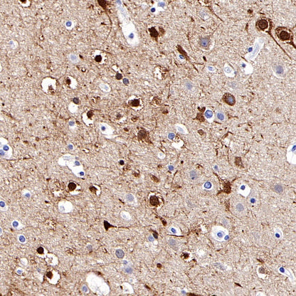 Beta II tubulin Rabbit polyclonal antibody