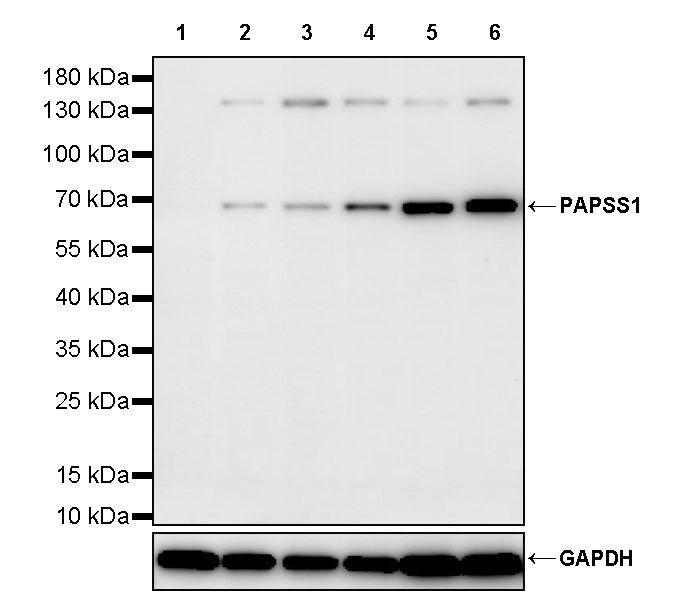 PAPSS1 Recombinant Rabbit mAb (S-3516-9)
