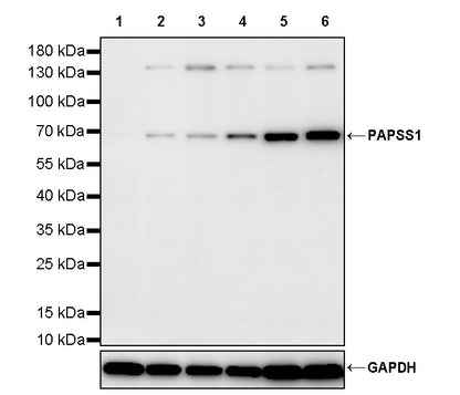 PAPSS1 Recombinant Rabbit mAb (S-3516-9)