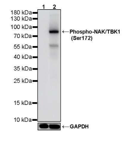Phospho-TBK1/NAK (Ser172) Recombinant Rabbit mAb (S-5532)