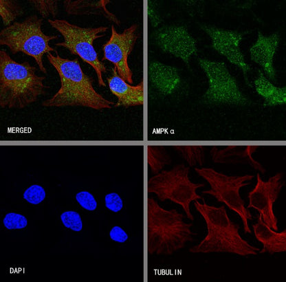 AMPKα Recombinant Rabbit mAb (S-784-68)