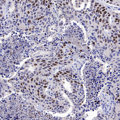 ATAD2 Recombinant Rabbit mAb (S-4145-63)