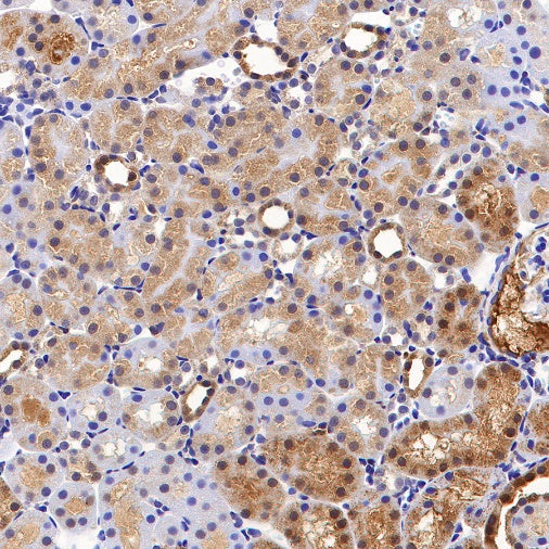 Glutathione Peroxidase 1 Recombinant Rabbit mAb (S-1714-17)