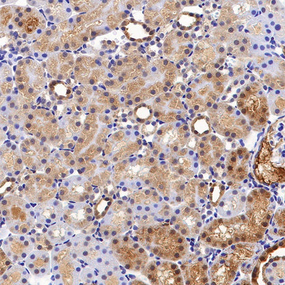 Glutathione Peroxidase 1 Recombinant Rabbit mAb (S-1714-17)