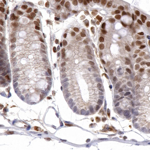 JunB Recombinant Rabbit mAb (S-R294)