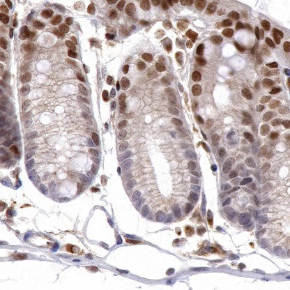 JunB Recombinant Rabbit mAb (S-R294)