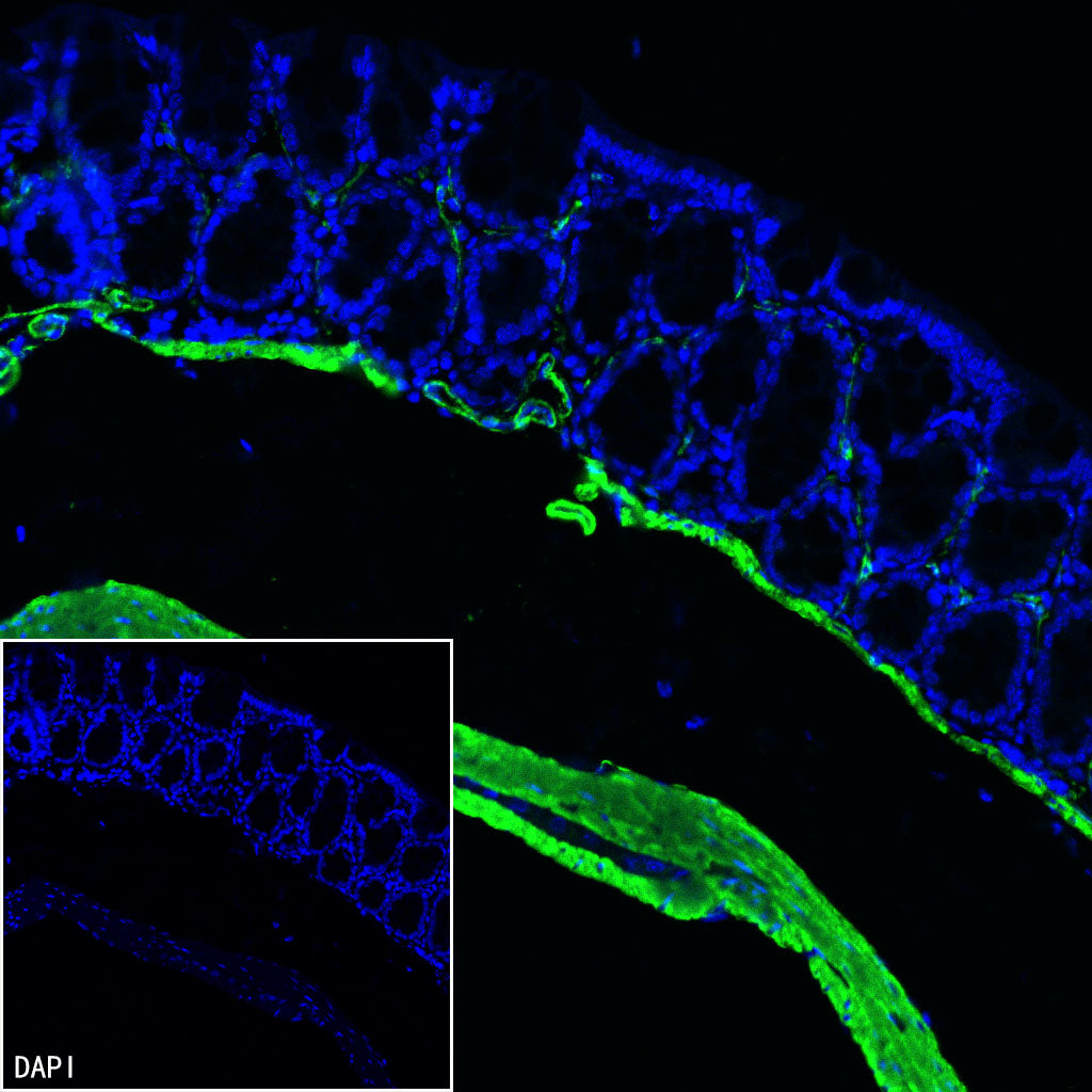 S-RMab® alpha smooth muscle Actin (SMA) Recombinant Rabbit mAb (SDT-301-142)