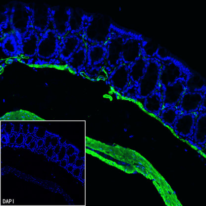 S-RMab® alpha smooth muscle Actin (SMA) Recombinant Rabbit mAb (SDT-301-142)