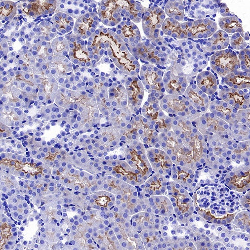 MYO7A Recombinant Rabbit mAb (S-2284-21)