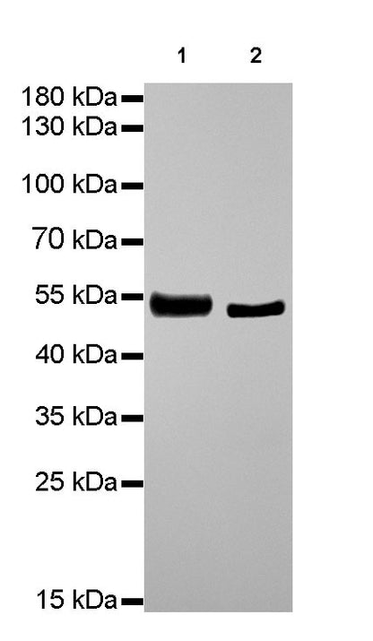 β-tubulin Recombinant Rabbit mAb (SDT-R014)