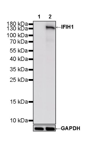 IFIH1 Recombinant Rabbit mAb (S-2413-49)