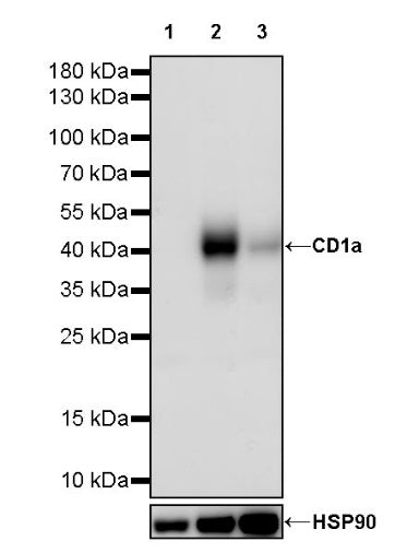 CD1a Recombinant Rabbit mAb (S-1486-65)