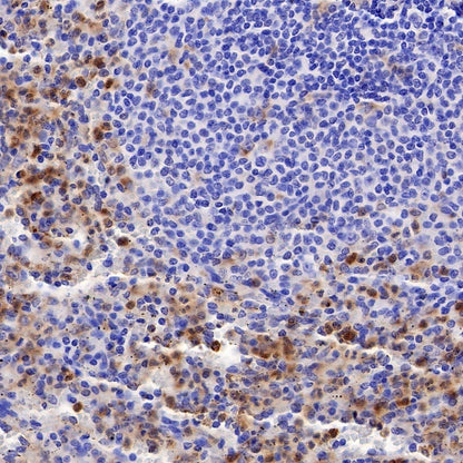Progranulin Recombinant Rabbit mAb (S-2202-59)