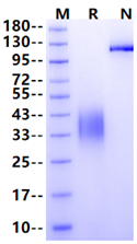 BTLA/CD272 His Tag Protein, Mouse
