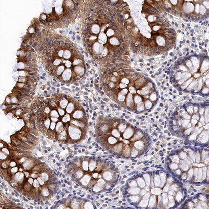 DFNA5/GSDME Recombinant Rabbit mAb (S-1703-1)
