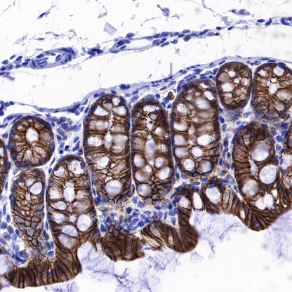 S-RMab® E-Cadherin Recombinant Rabbit mAb (SDT-438-5)