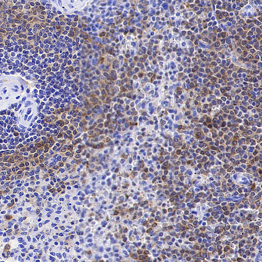 Syk Recombinant Rabbit mAb (S-4400-11)